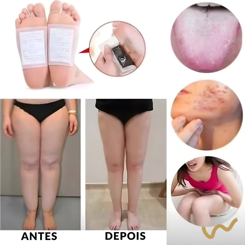 Caixa de adesivo DETOX FLOWAH™ c/ 30 unidades – DESINTOXICAÇÃO PELOS PÉS